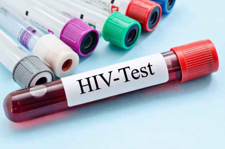 HIV patients not on treatment – New report reveals